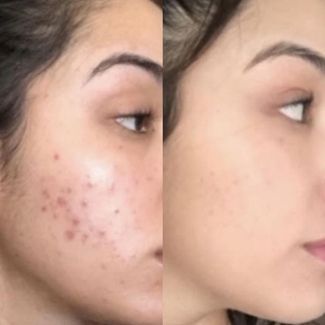 <p>Why Women Love Zenvera<br/><br/></p>