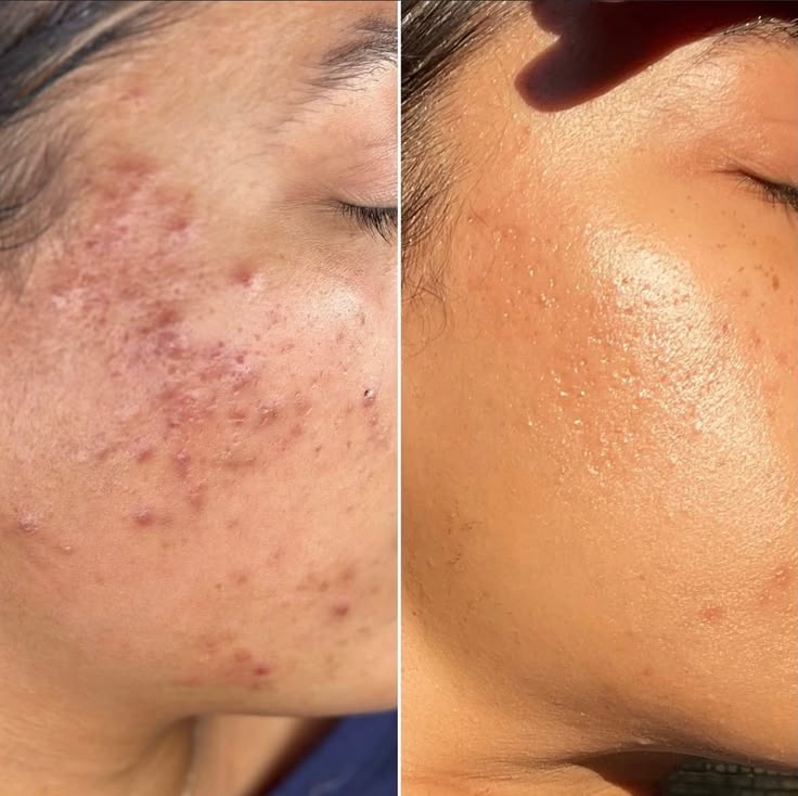 <p>Why Women Love Zenvera<br/><br/></p>